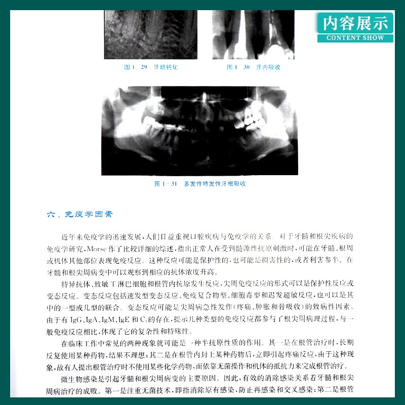 一步一步做好美學修復牙體預備+Step by Step:一步一步做好根管治療(圖譜) 一步一步做好美學修復牙體預備+Step by Step:一步一步做好根管治療(圖譜)