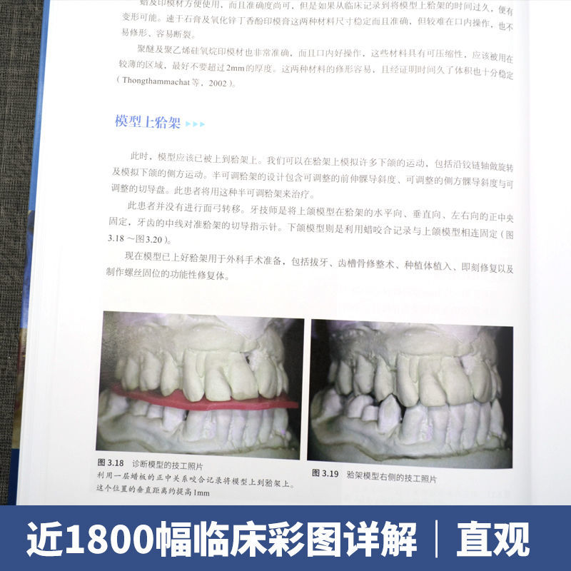 口腔精萃系列--口腔種植工藝操作流程:分步驟操作指南 口腔精萃系列--口腔種植工藝操作流程:分步驟操作指南