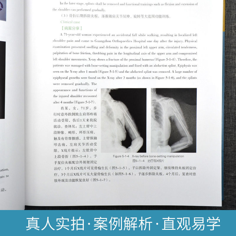 黃氏正骨手法薈萃（英漢對照）