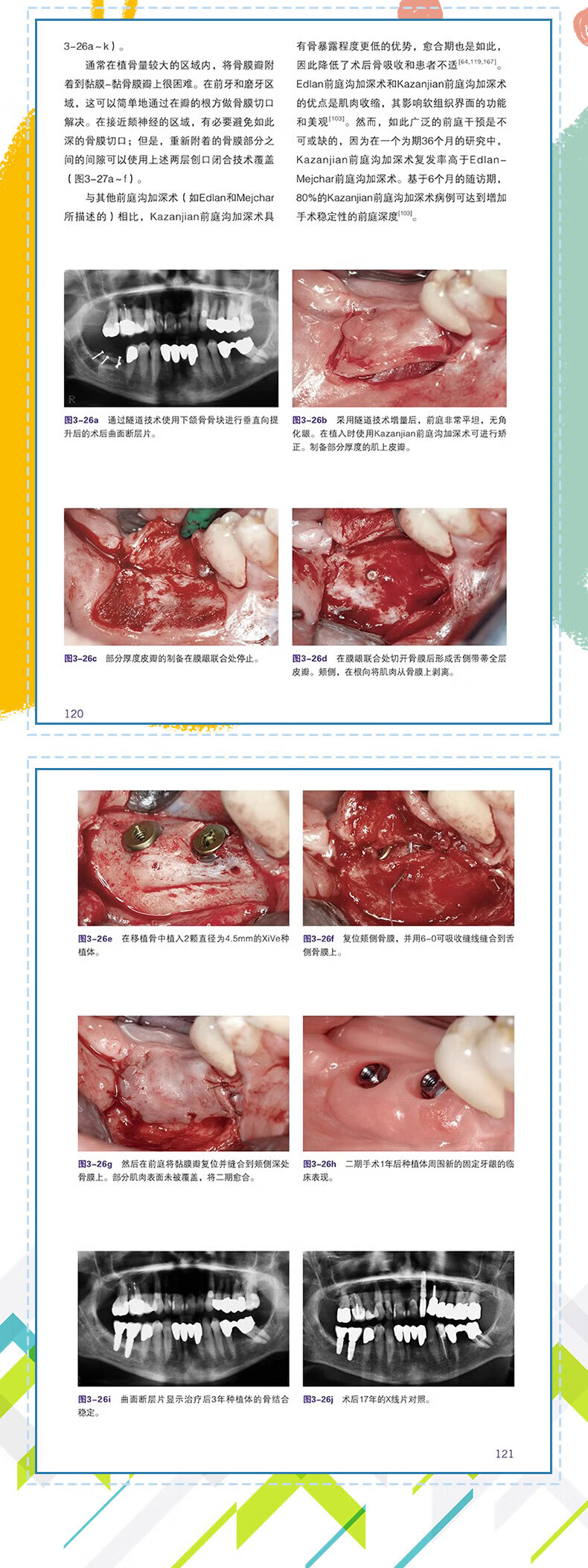 1699096496213229.jpg 详情5.jpg