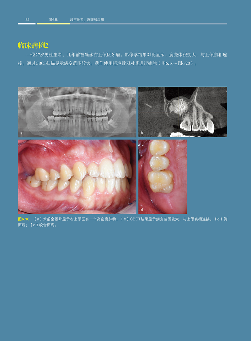 1702890608290510.jpg 详情16.jpg