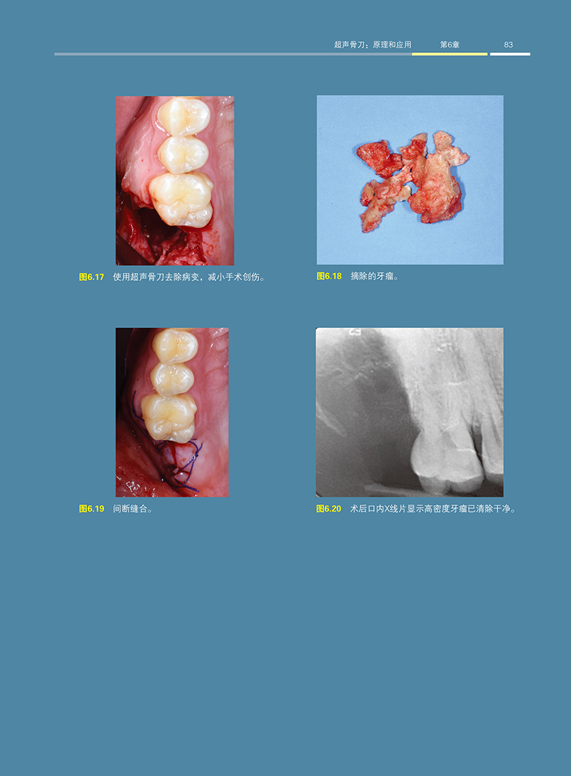 1702890612229171.jpg 详情17.jpg